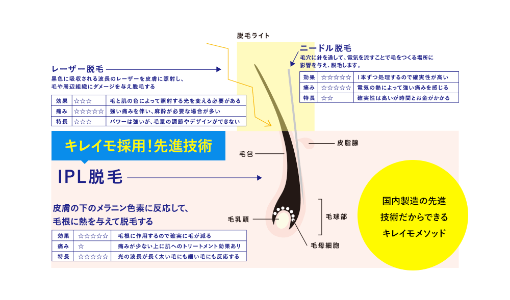 キレイモ採用！最新技術！国内製造の最新技術だからできるキレイモメソッド