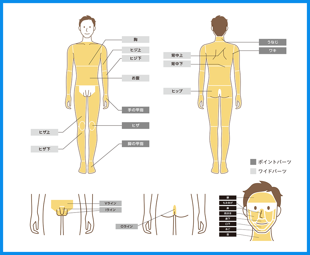 全⾝の気になるポイントを脱⽑