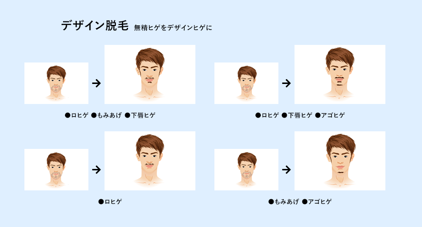 REASON 03 Image - デザイン脱毛 無精ヒゲをデザインヒゲに