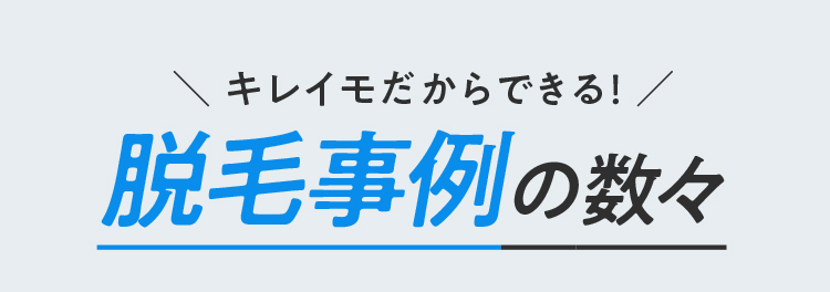 キレイモだからできる！脱毛事例の数々