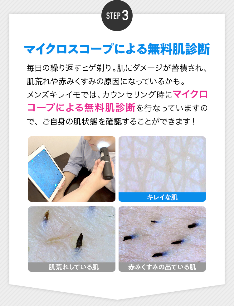 STEP3 マイクロスコープによる無料肌診断 毎日の繰り返すヒゲ剃り。肌にダメージが蓄積され、肌荒れや赤みくすみの原因になっているかも。メンズキレイモでは、カウンセリング時にマイクロコープによる無料肌診断を行なっていますので、ご自身の肌状態を確認することができます！