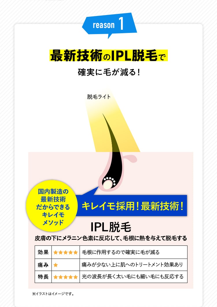 reason1 最新技術のIPL脱毛で確実に毛が減る！ 国内製造の最新技術だからできるキレイモメソッド キレイモ採用！最新技術！