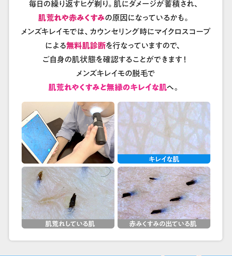毎日の繰り返すヒゲ剃り。肌にダメージが蓄積され、肌荒れや赤みくすみの原因になっているかも。メンズキレイモでは、カウンセリング時にマイクロコープによる無料肌診断を行なっていますので、ご自身の肌状態を確認することができます！メンズキレイモの脱毛で肌荒れやくすみと無縁のキレイな肌へ。